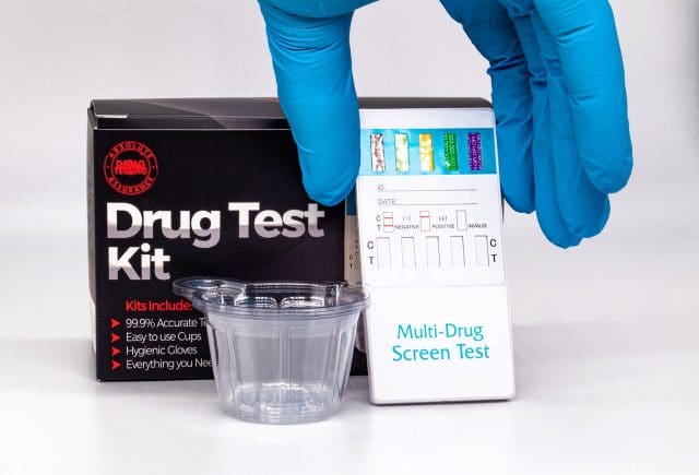 5 Things to Know About Urine Testing