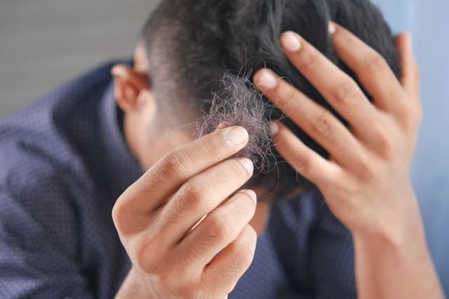 Key Reasons for Hair Loss in Men and Ways to Implement Restoration