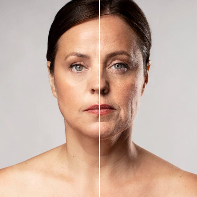 Assessing If Facelift Surgery is Right for You?